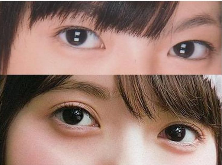 natural double eyelid